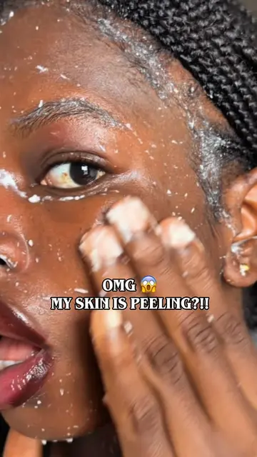 A little exfoliation to get rid of all that dead skin buildup ✨  This peeling ge