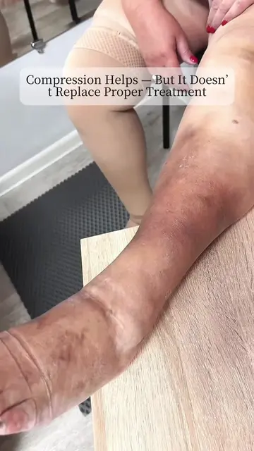 Shop Compression Support at OnHealthWay.com 🦵 Compression socks can help suppor