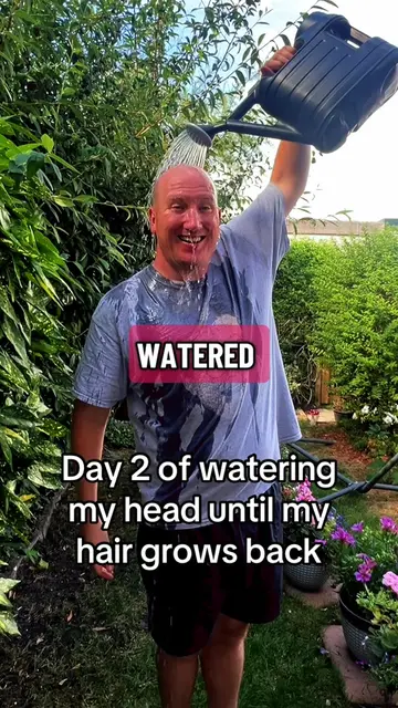 Day 2 of watering my head until my hair grows back 