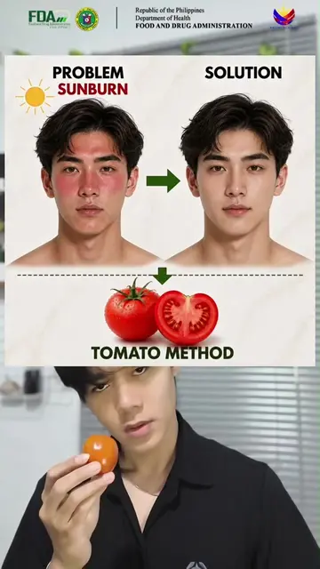 Acne scars and dark spots on my face 🤯 Keep using it and my face will gradually