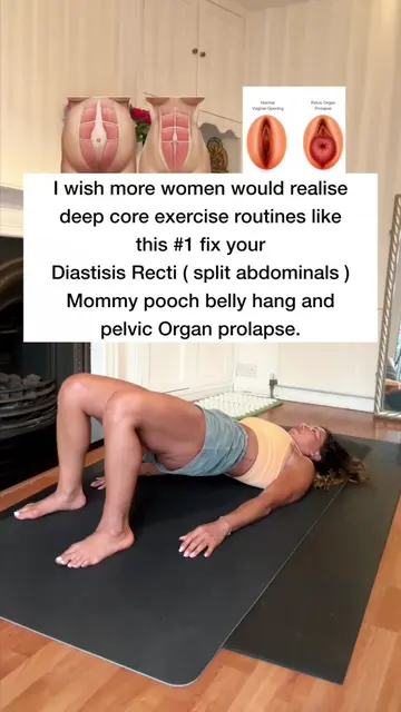 Ladies, moms! 🌹 If you’re struggling with a mummy pooch, Diastasis Recti, pelvi