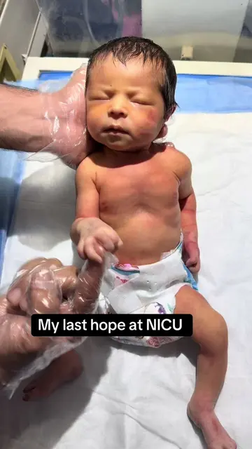 My last Hope at NiCu #newborn #lasthope #mostsearch #pleasepray #viralpost 