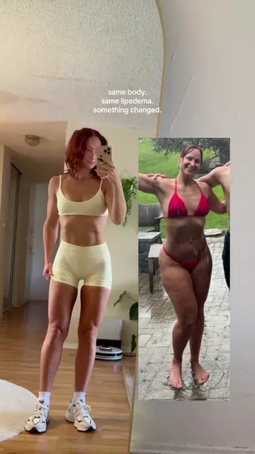 So what actually changed for me? (PS this is all completely WITHOUT surgery)  💛