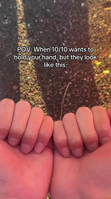Re made it haha #calisthenics #callous #GymTok #relatable #hands
