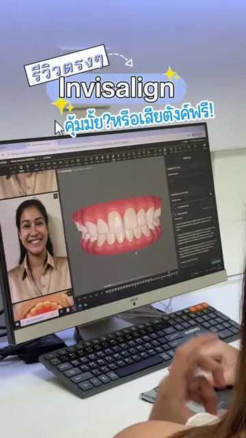 แก้ปัญหา“ยิ้มแล้วหน้าเบี้ยว!” ด้วยการจัดฟันครั้งสุดท้ายในชีวิต🥹 ขอเลือกการจัดฟั