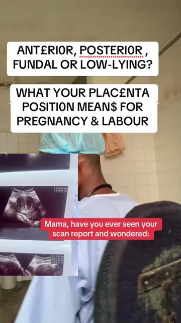 “What does anterior placenta mean?” “Is posterior placenta better?” “Will my pla