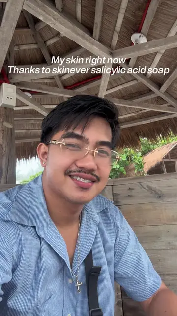 Bago magpa puti unahin mo yung pimples mawala at mga pimples marks… @SKINEVER PH