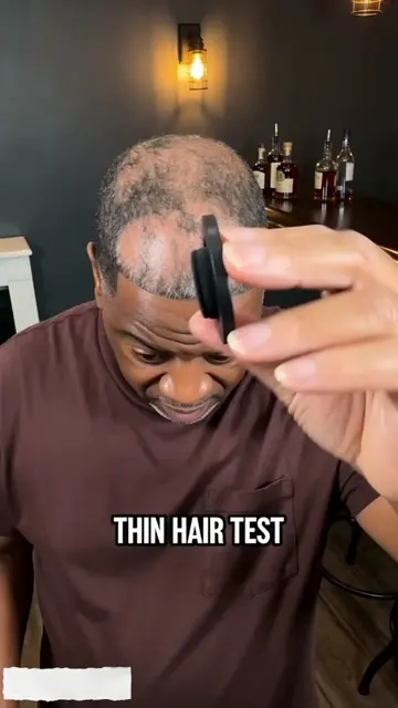 If you have thin hair and a visible hairline,and lack confidence every time you 