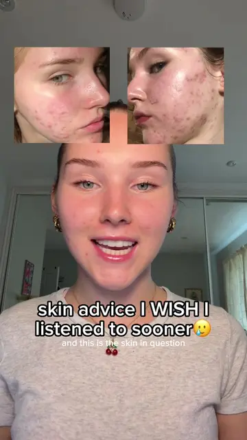 ad I made the mistakes so you don’t have to 🥲🫣 for those asking, the blemish b