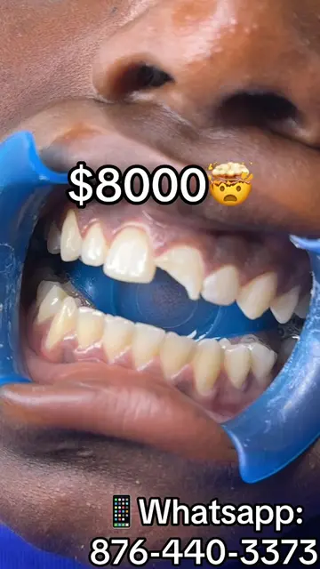 Confidence restored! Book with the best in Portmore!  Starting price for this se