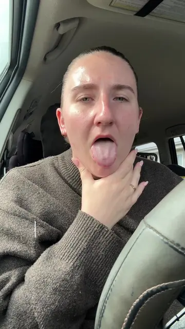 PART 2: Dr trip - allergy specialist- epi pen 💀☠️ last time eating pistachio an