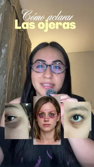 4 activos que tienes que usar si o si para aclarar las ojeras, el eye cream de k