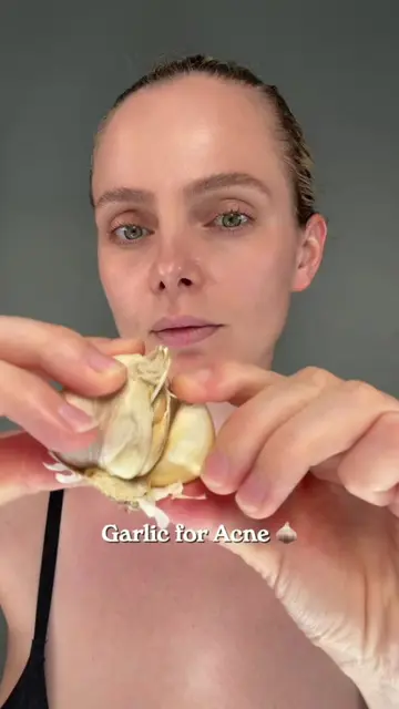 Garlic for acne 🧄 #KBeauty #skincare #skin