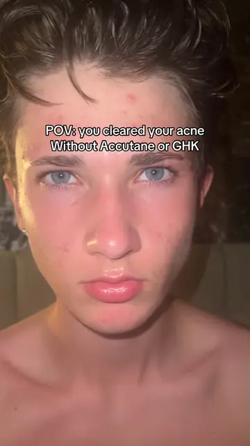 Do I drop how? #skincare #SelfImprovement #GlowUp #creatorsearchinsights #viral 