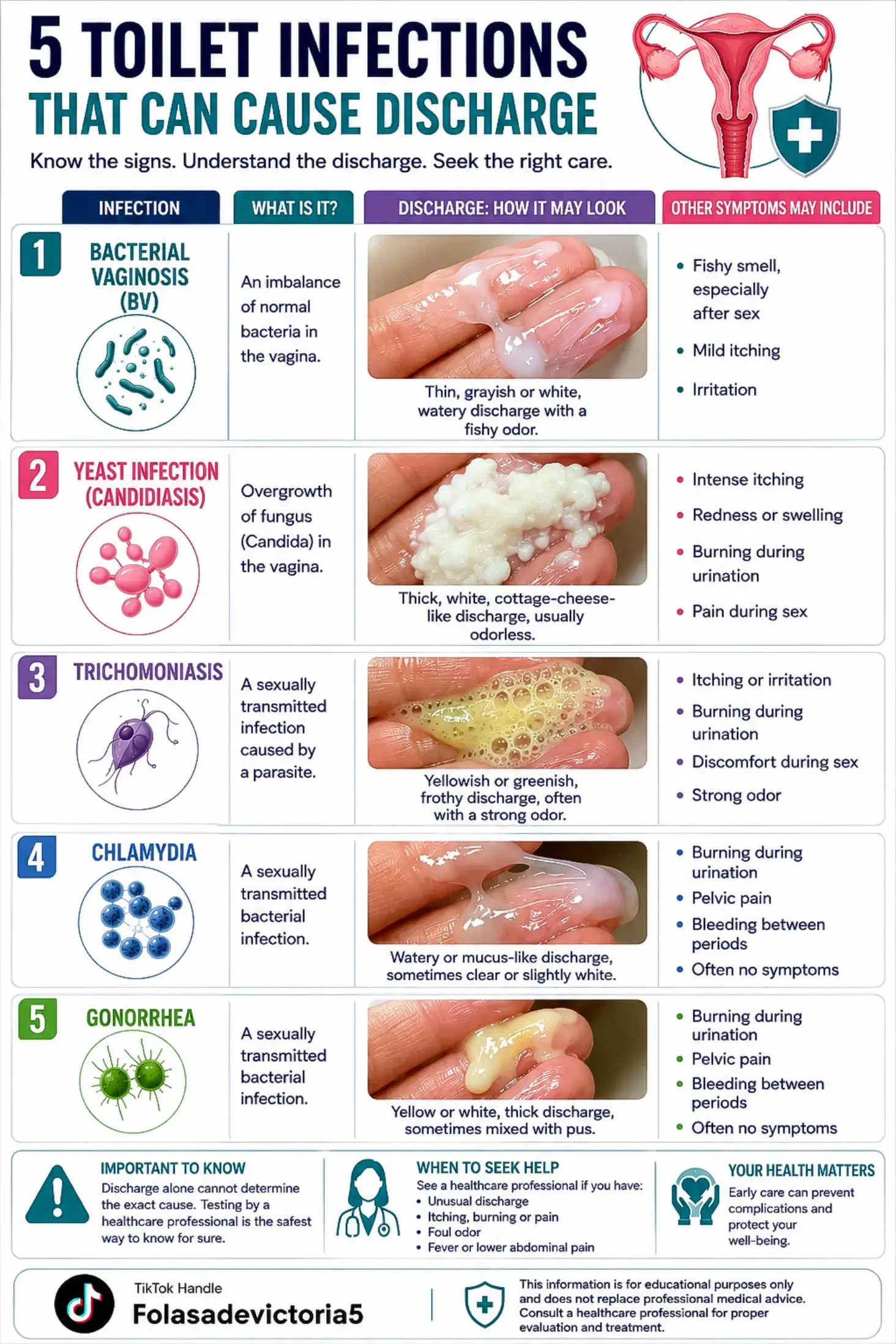 Here are 5 common conditions that may cause changes in vaginal discharge, plus o