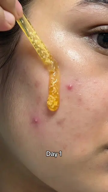 Medicube Kojic Acid Turmeric Serum for face and body ✨🥰 @medicube global @medic