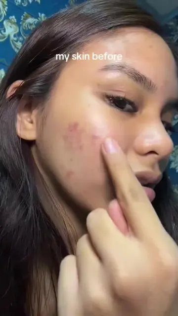 Just 7 days! My skin glows bright every single morning ☀️