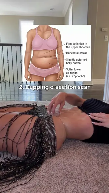 That stubborn postpartum “BELLY POOCH” may NOT mean you need more ab tension… 👀