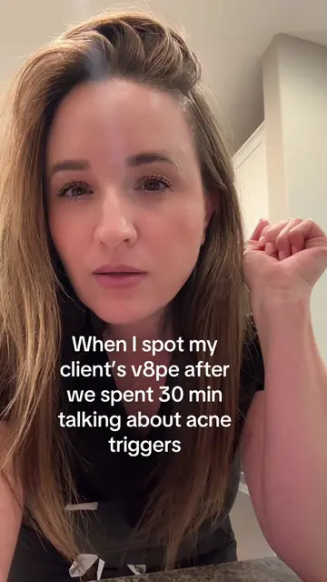 True story 🥴 #acnetriggers #acne #acnetips 