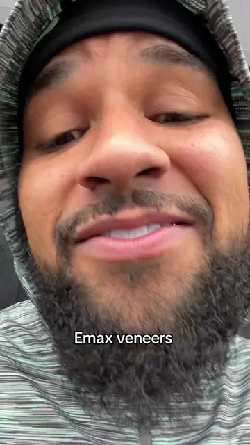 Turkey Emax veneers 🇹🇷 #turkeyteeth #veneersjourney #emaxveneers
