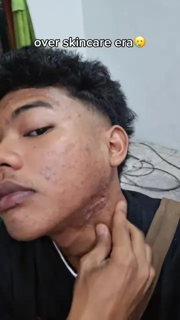 Ramai tanya kulit saya cantik sebab apa 👀 Cuba sabun ni! 🧼✨MBZ-ZMZ#Niacinamide