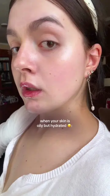 oily dehydrated VS oily but hydrated skin ✨ #beforeafter #glowyskin #oilyskin #d
