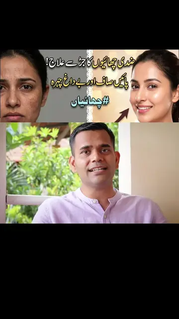​#SkincareRoutine  ​#ClearSkin  ​#PigmentationTreatment  ​#HomeRemedies  ​#TikTo