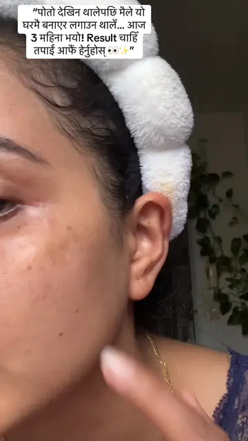 पहिला मेरो फेसमा पोतो देखिन थालेपछि मैले घरमै बनाएको Rice Toner try गर्न थालेँ �