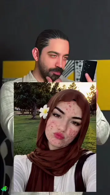 سيلفي بالبشرة الطبيعية✨ أظهر ملمس البشرة الحقيقي مع حب الشباب، جرب هذا القالب ال