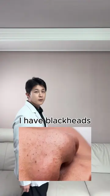 5 skin concerns. 1 answer. Salicylic Acid covers: ✨ blackheads ✨ whiteheads ✨ oi