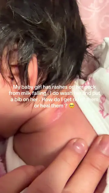 Please help me heal my baby girl 🥺💔 Luckily she hasn’t been in pain she was cr