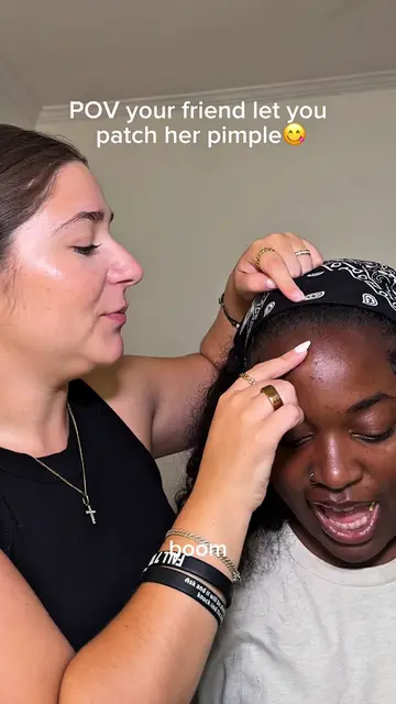 Another pimple patch client😝 tag your pimple besties🤭 #pimplepatch #pimplepatc
