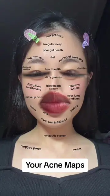 #foryou #koreanskincare 