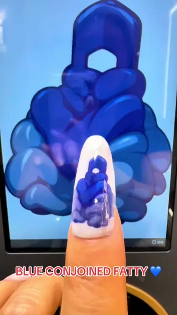 You asked, you voted—so I printed Blue Conjoined Fatty! 💙😂💅 Another unusual r