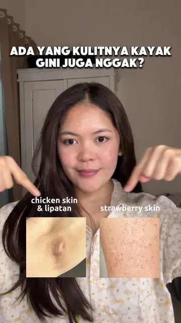 say Hello to smoother skin fr!✨🫶🏻 #Nexderm #ChickenSkin #AdvanceBumpLotion #Ba