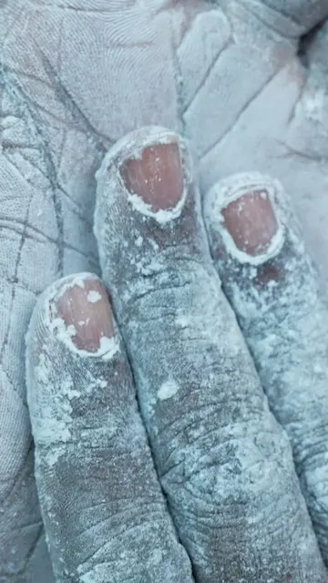 I get asked what is the white stuff on my hands all the time, I can ask why are 