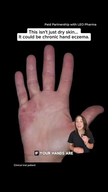 #ANZUPGOPartner #Ad Watch for important safety information. The more you know: c