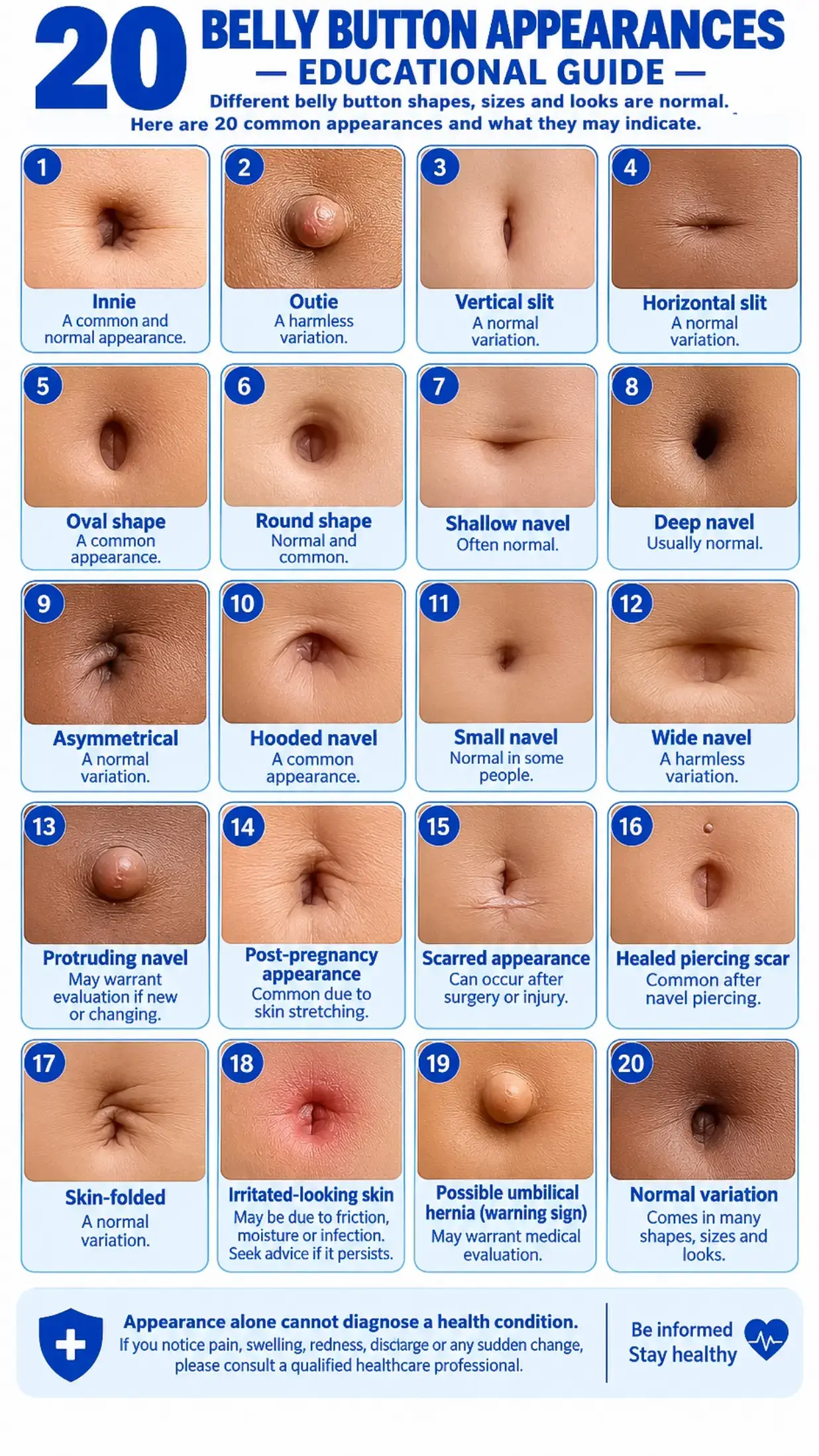 🩺 Did you know? Belly buttons come in different shapes, and most are completely