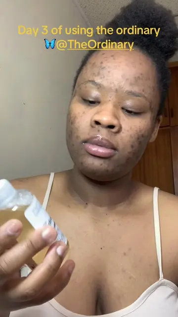 #theordinary #skincare 🦋