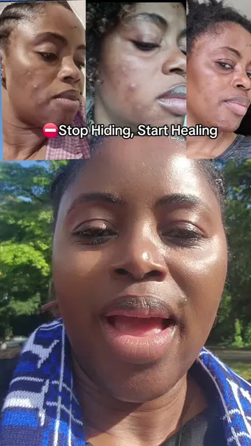 Your Makeup is Secretly Ruining Your Skin 🚨Go Natural & Watch Your Skin Transfo