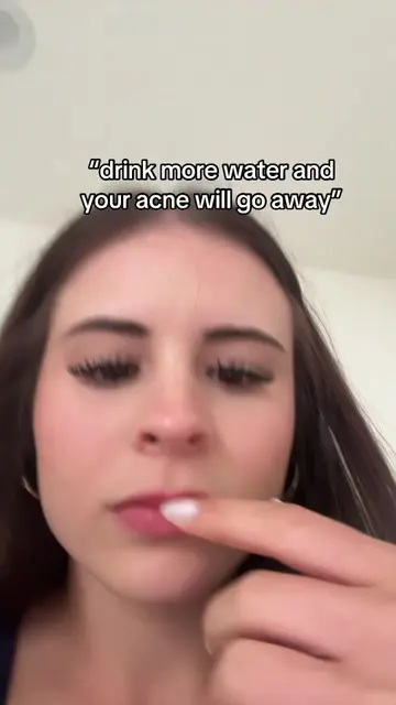 do NOT listen to this advice if you need help consult with a professional who kn