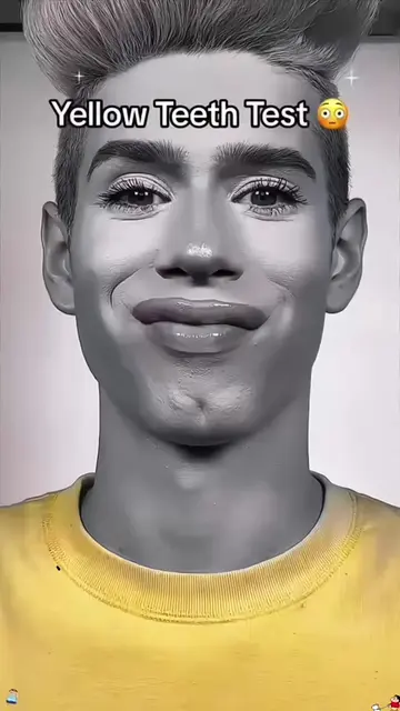 +Yellow teeth in England 🇬🇧 🇺🇸 Yellow teeth filter🔥. yellow teeth test filt