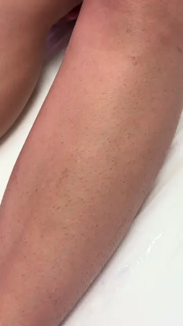 She’ll be back!!! A little more growth + exfoliating 2/3x weekly…we’ll be good t