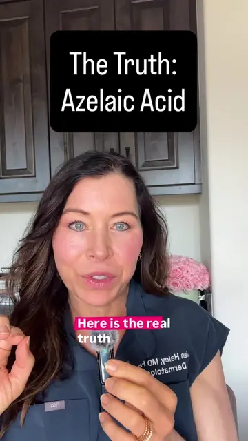 #azelaicacid is being overhyped It is an option but definitely not the solution 