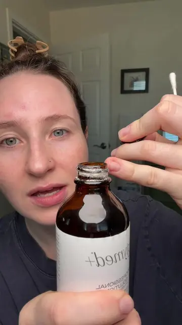 Salicylic acid concentrated peels are one of my favorite ways to spot treat acne