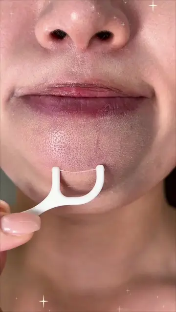ith 5% Niacinamide – scientifically balanced and gentle #blackheads #whitening #