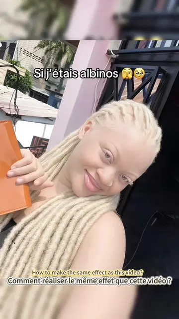 ✨🤍 Crée ton propre effet **Comment rendre ta photo albinos** avec l’IA ! 🌞📸 T