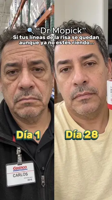 ing to consistency is Key  look at that difference 🔥✨⚡️🧴👀 w-9.75 #antiwrinkle
