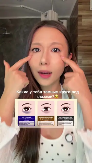 Какой у вас тип тёмных кругов под глазами? 👀 Коричневые из-за пигментации? Сини