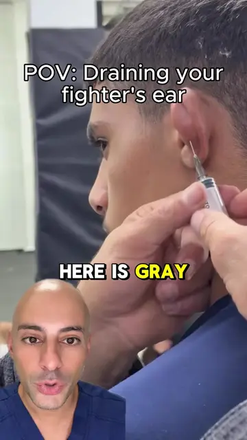 Doctor reacts, this MMA gym is draining what's likely cauliflower ear, and here'
